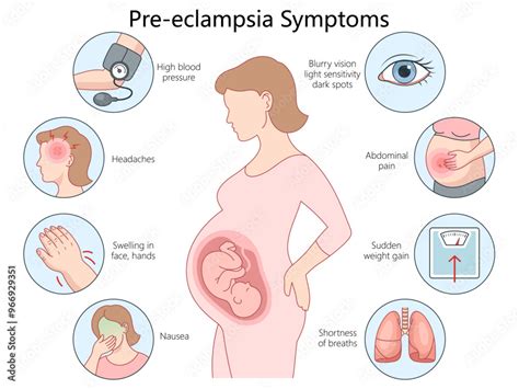 Eclampsia Pregnancy