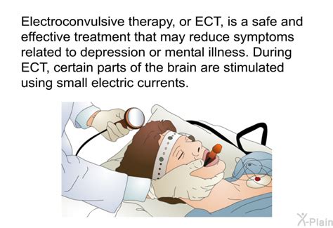 Can ECT Therapy For Depression Really Provide Long-Term Relief?