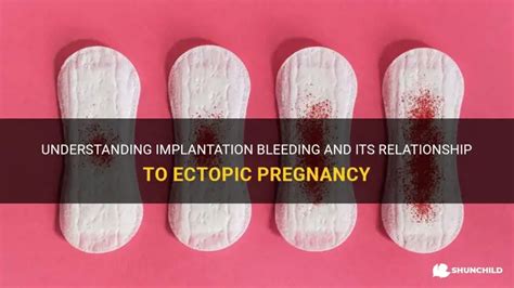 Ectopic Pregnancy Bleeding: Early Signs and Symptoms Revealed