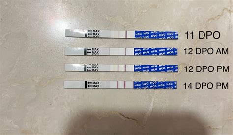ectopic pregnancy line progression