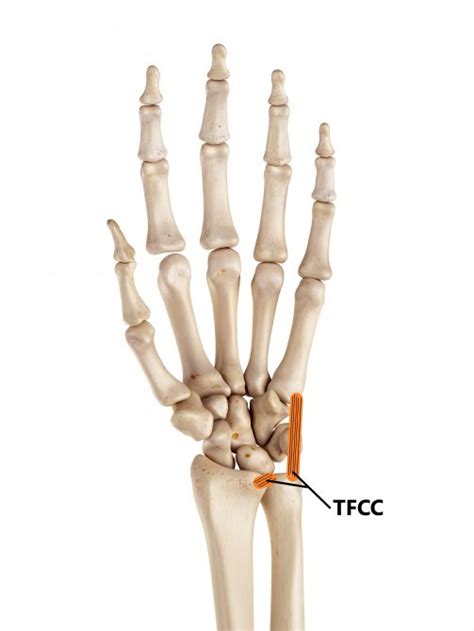 ecu vs tfcc injury