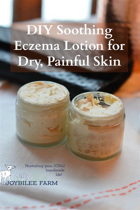 Diy Eczema Cream – A Natural Solution To Your Eczema Problems