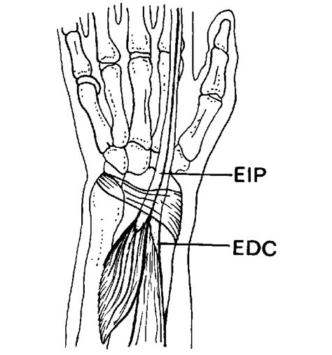 edc and eip tendons