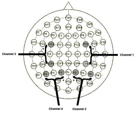 Eeg Electrode Bipolar