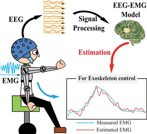 5 Key EEG vs EMG Differences