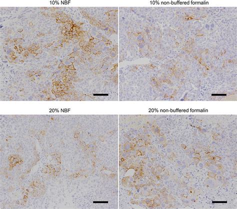 Effect Of Fixative On Staining