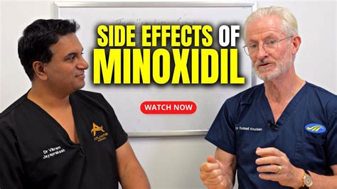 Effectiveness of Minoxidil