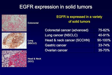 egfr expression in solid tumor tissues