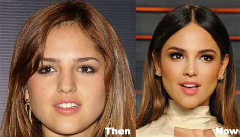 eiza gonzalez actress before surgery