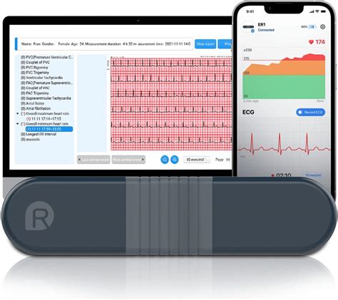 Ekg Monitor For Iphone