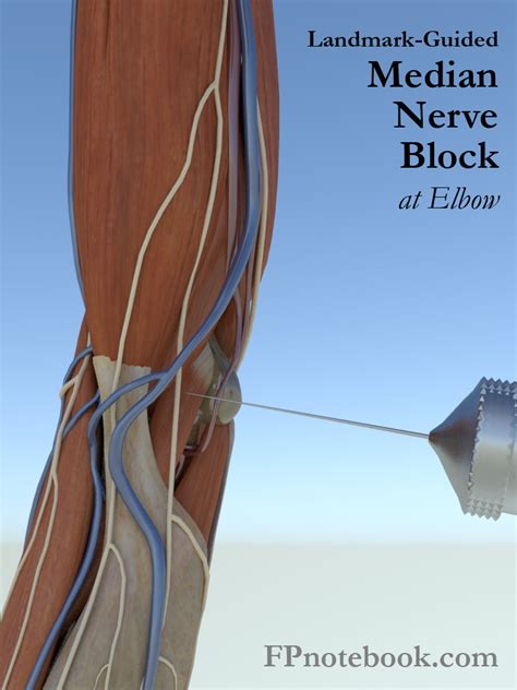 Elbow Nerve Block