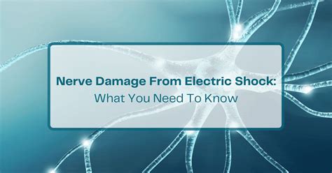 Electric Shock Neuropathy