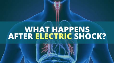 Electric Shock Of Pacemaker