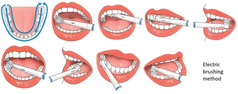 Electric Toothbrush Method