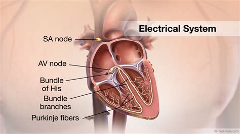 Electrical Impulse Heart Problems