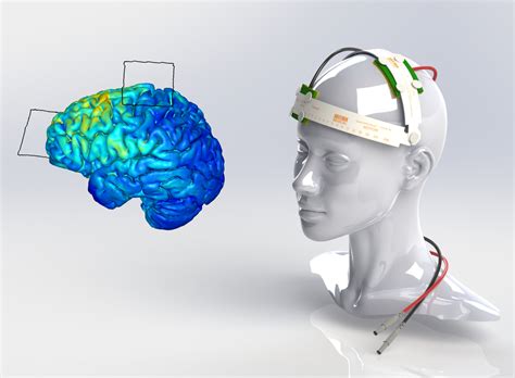 electrical stimulation of the brain esb
