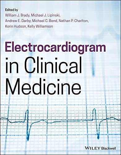 electrocardiogram in clinical medicine pdf