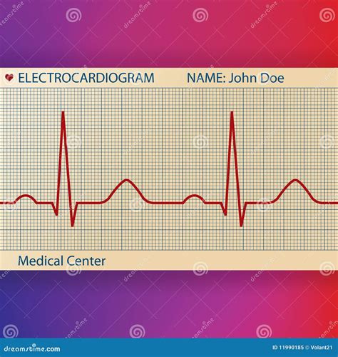 Electrocardiogram Paper