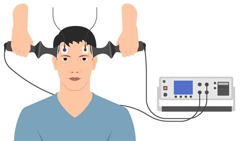 Can Electroconvulsive Therapy for Depression Be the Breakthrough You've Been Searching For?