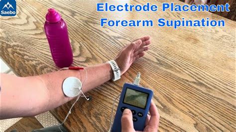 Electrode Placement Supination