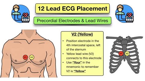 Electrodes Procedure Code