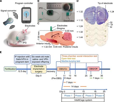 Electrodes Rat Brain
