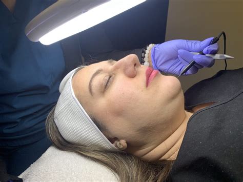 Electrolysis Edmonton Reddit