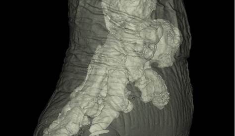 Reconstructed CT scan of elephant foot Collection