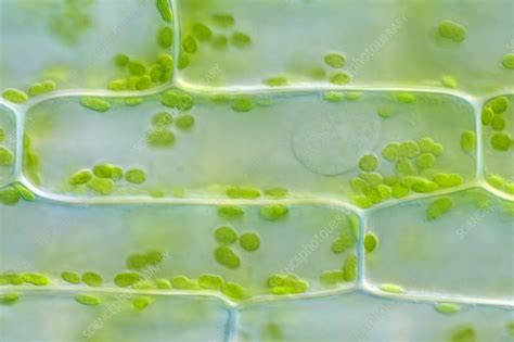 elodea leaf under microscope