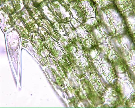 elodea under microscope