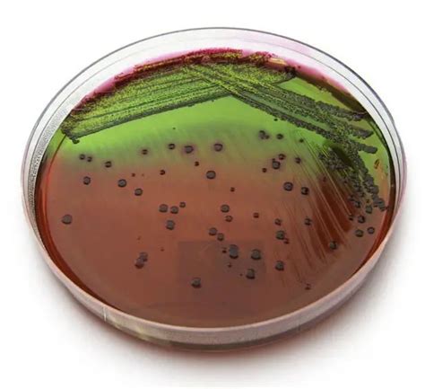 emb agar is selective for