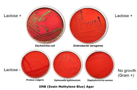 emb agar plate results