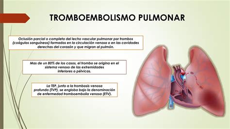 embolismo pulmonar que es