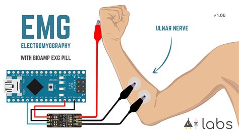 Emg Electrode Measurement