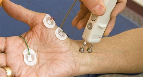 Uncover Nerve Damage with EMG Nerve Conduction Test