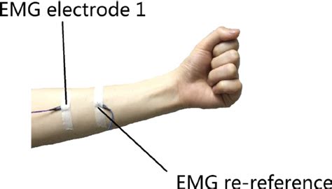 Emg Reference Electrode