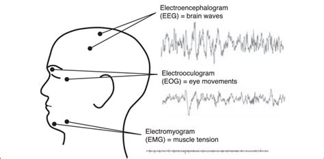 EMG vs EEG: Key Differences