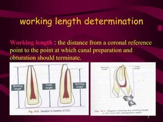 Endo Reference Point