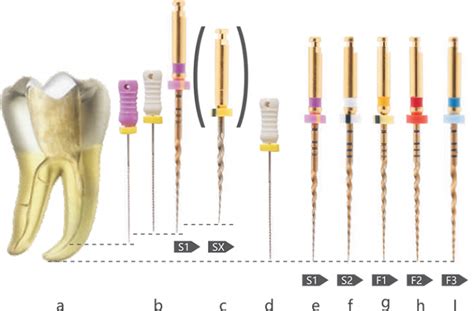 Endo Size Chart
