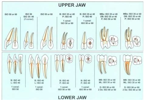 Endodontic Access Closure Code