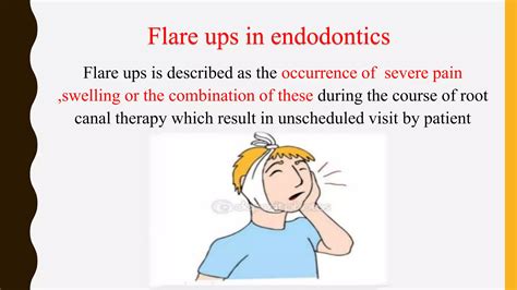 Endodontic Flare-Up