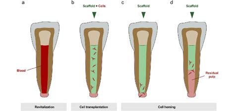 Endodontic Regeneration