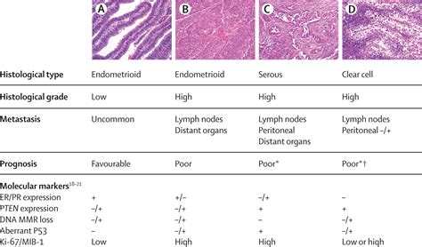 endometrial cancer grade 1
