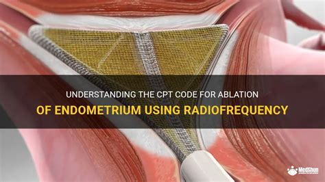 endometrial cpt code