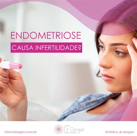 endometriose causa infertilidade