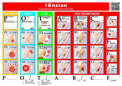 endometriose enzian