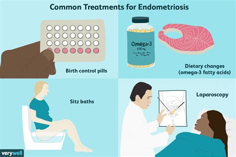 endometriose traitement