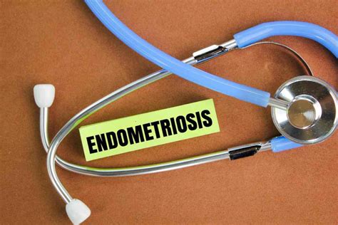 endometriosi quali esami fare