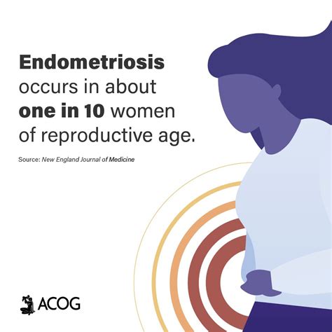 endometriosis acog faq