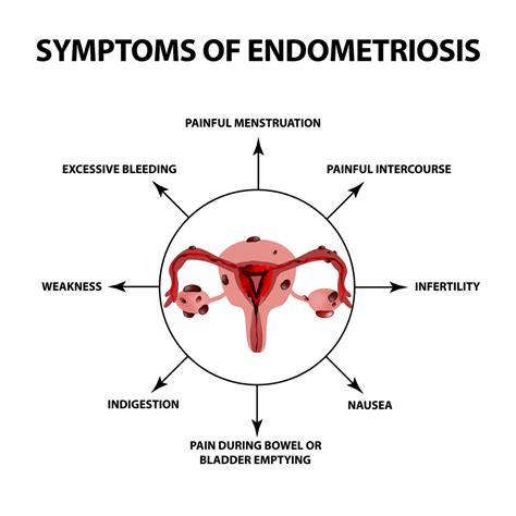 endometriosis medical term definition